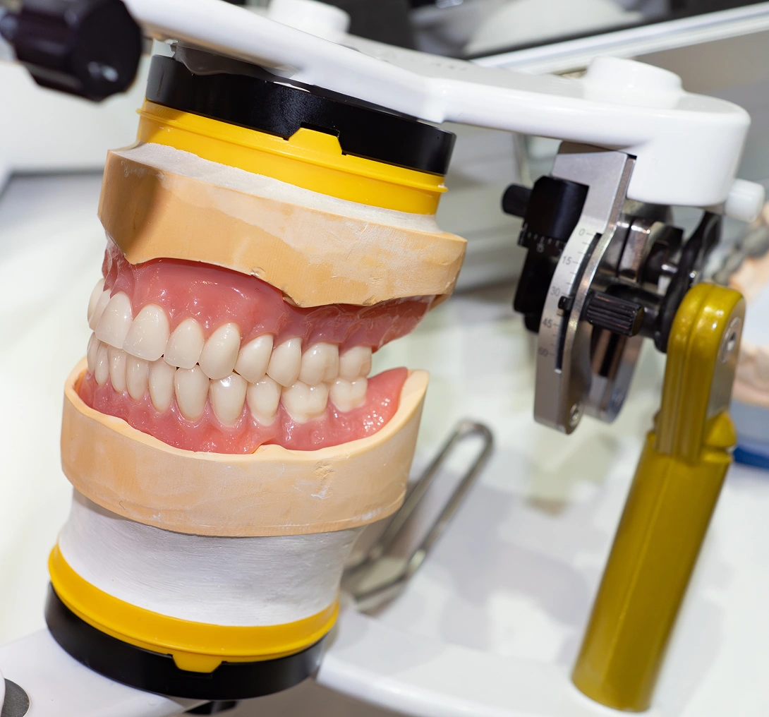 Dental model with artificial teeth displayed.