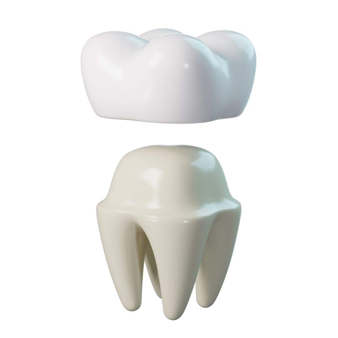 Dental crown and tooth model illustration.