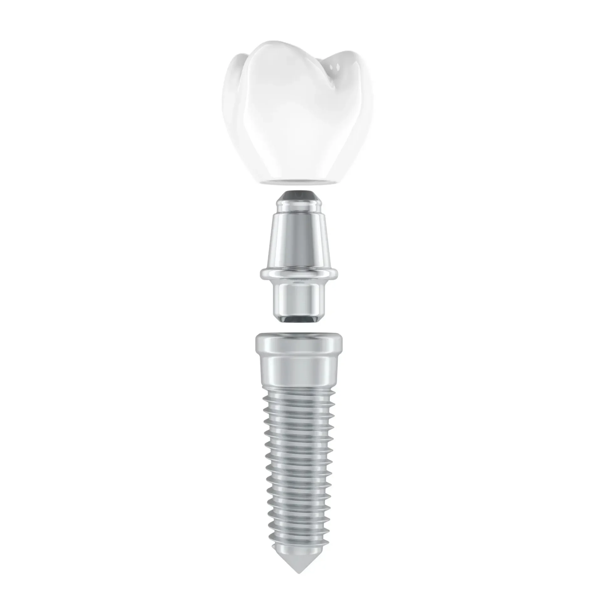 Dental implant with crown and abutment components.