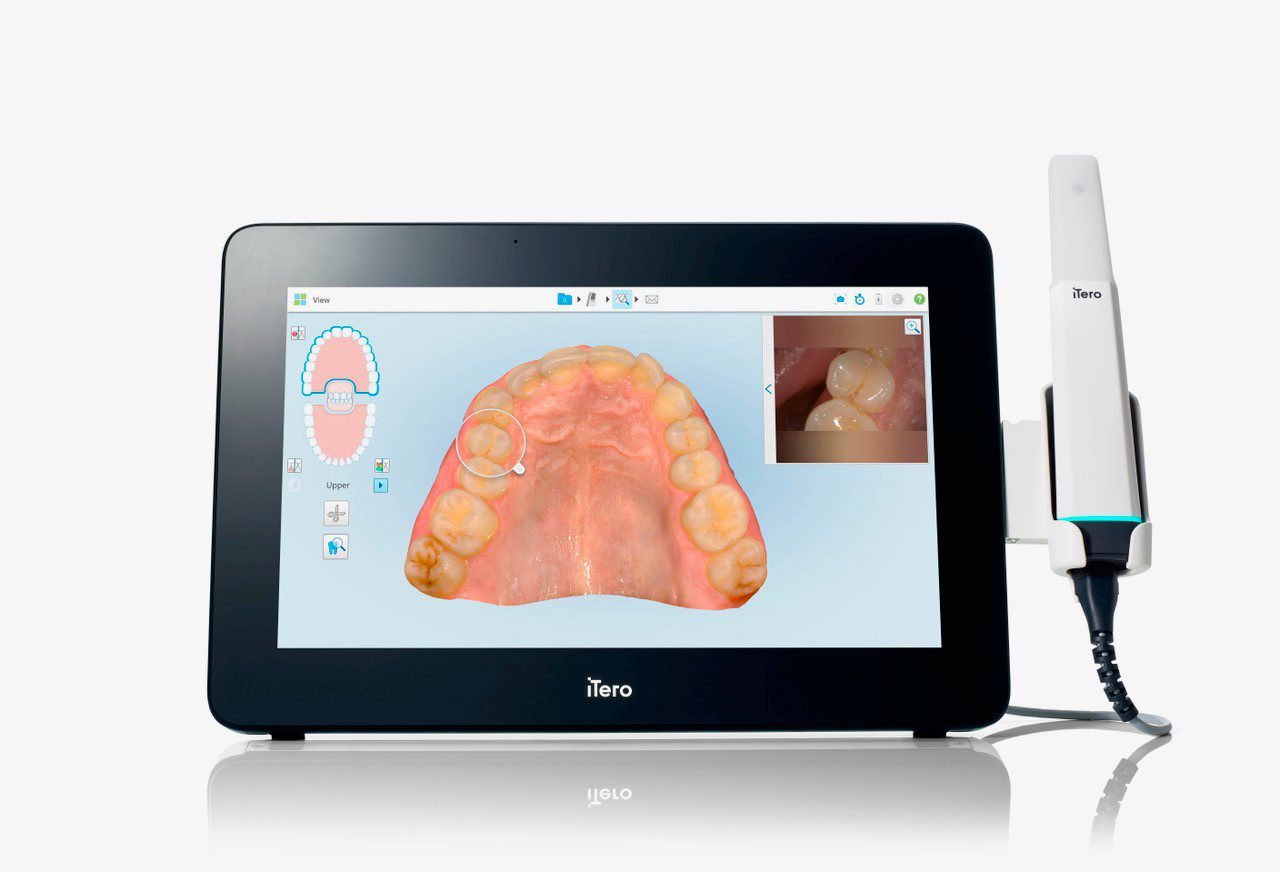 Dental scanning device with digital teeth image.